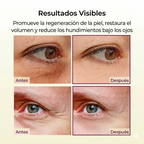 Before and after effects of eye cream on skin texture and volume